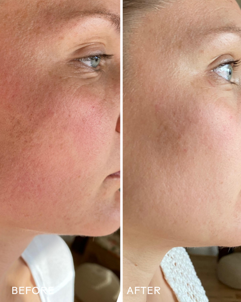 Three Ships Skin Hero Bakuchiol + Calendula Bio-Retinol Serum 30mL - YesWellness.com