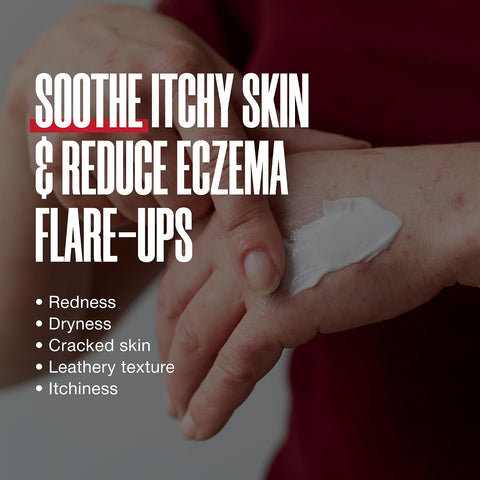 Zax's Original Eczema Repair Cream 140mL