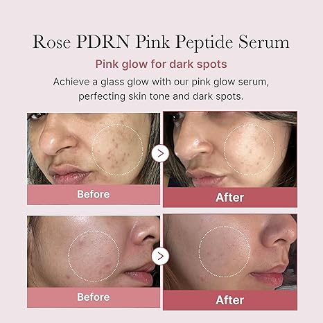 Medicube PDRN Pink Peptide Glow Serum 30mL