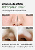 Celimax Ji Woo Gae Heartleaf BHA Peeling Pad 125mL / 60 Pads