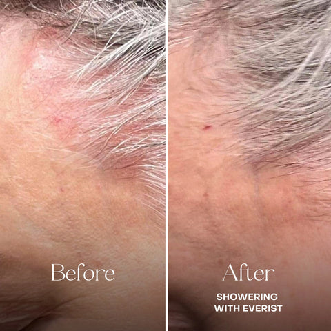 Everist The Fragrance-Free Conditioning Concentrate 100mL