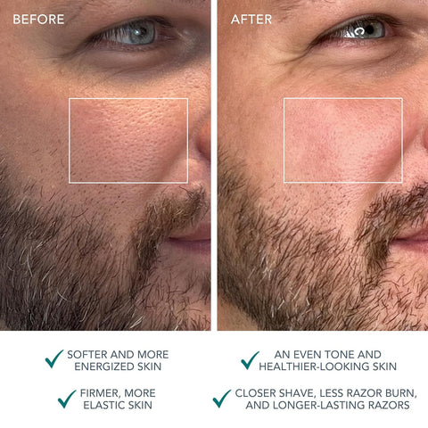 Foreo Luna 4 2-In-1 Smart Facial Cleansing & Firming Device Men - YesWellness.com