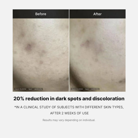 Medicube Deep Vita C Ampoule 2.0 - 10 g × 3